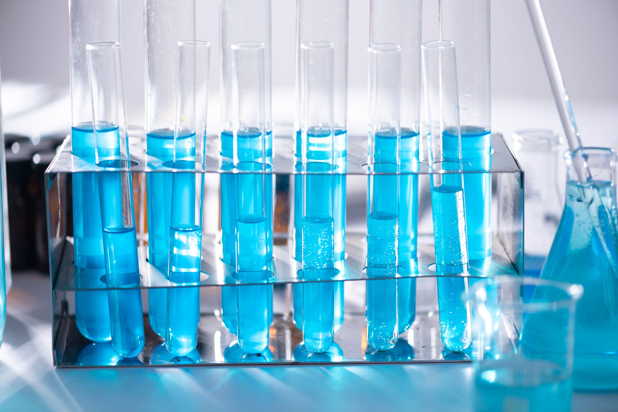 Laboratory test tubes and clinical samples prepared for diagnostic testing